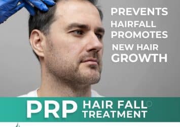 PRP Treatment