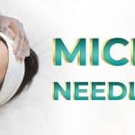 Microneedling Facial