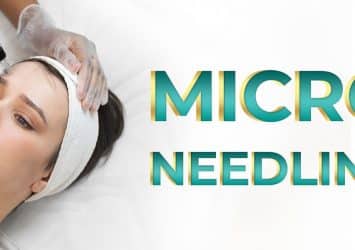 Microneedling Facial