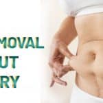 Belly Fat Removal