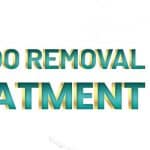 Laser Tattoo Removal