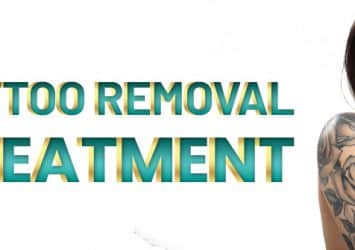 Laser Tattoo Removal