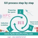 IUI Treatment in Hyderabad