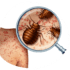 bed bug control in dubai