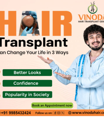 hair transplant