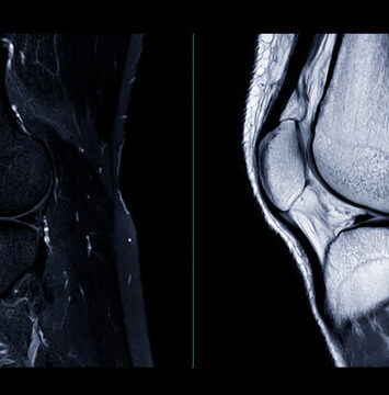 360 F 740385958 3NZNHlD4p0hbZ0OKdRiPDOgOfAbtcEYx