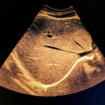 istockphoto 1322425857 612x612 1