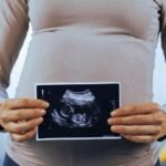 pregnant woman with ultrasound