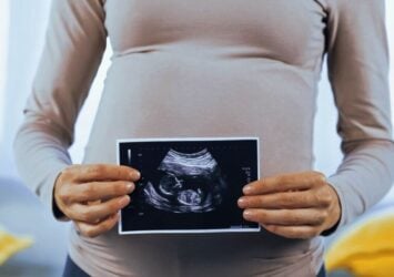 pregnant woman with ultrasound