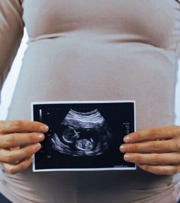 pregnant woman with ultrasound