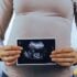 pregnant woman with ultrasound