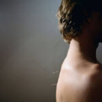 Acupuncture Upper East Side Treatments