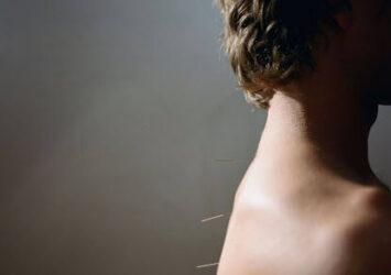 Acupuncture Upper East Side Treatments