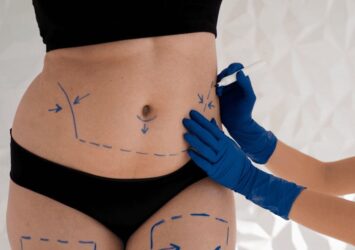 Non-surgical Liposuction in Dubai -Dr. Mohan Plastic Surgeon