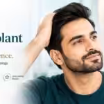 Chemical Peel Treatment in Jabalpur | Ojas Clinic